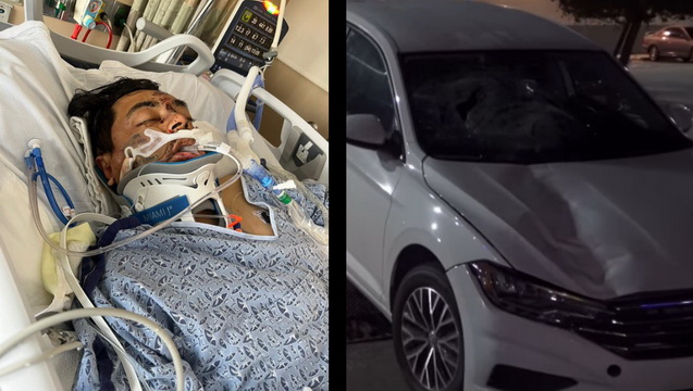 Donations for Jose Hernandez Hit and Run Medical