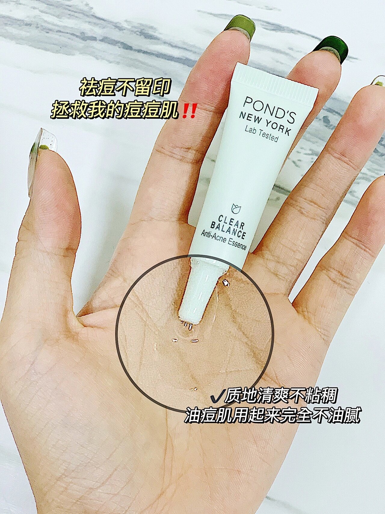 酷牌库|商品详情-进口代理批发4支=20ml~旁氏水杨酸战痘精华液祛痘闭口粉刺淡化痘印控油小样