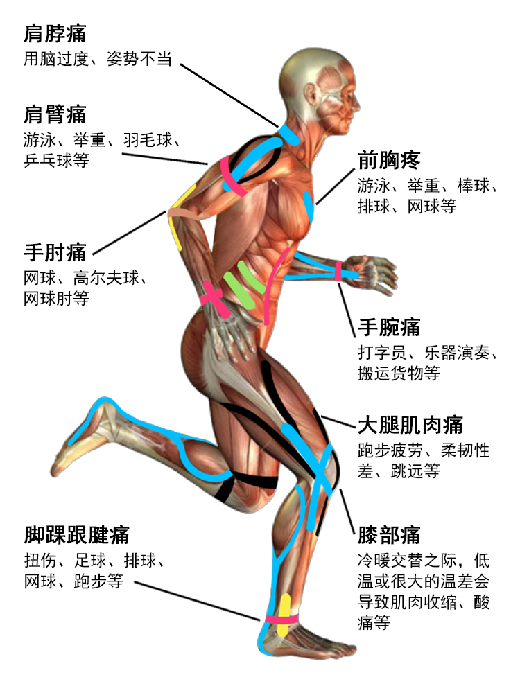 酷牌库|商品详情-进口代理批发肌内效贴李娜贴布彩色肌贴肌肉酸痛放松弹性胶布运动防护简易护膝