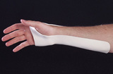 AliMed 51-223- Ulnar Gutter Wrist Splint - Medium/Large