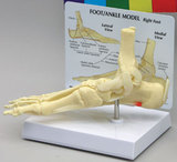 AliMed 70574- Anatomical Model - Plantar Fasciitis