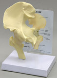 AliMed 70579- Anatomical Model - Basic Hip