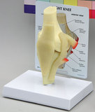 AliMed 70580- Anatomical Model - Basic Knee