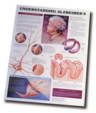 AliMed 80445- Understanding Alzheimer's