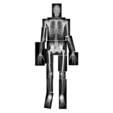 Roylco R-5911 True To Life Human X-Rays