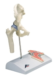 3B Scientific 12-4517 3B Scientific Anatomical Model - Mini Hip Joint With Cross Section Of Bone On Base - Includes 3B Smart Anatomy