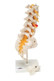 3B Scientific 12-4543 3B Scientific Anatomical Model - Lumbar Spinal Column With Dorso-Lateral Prolapsed Disc - Includes 3B Smart Anatomy