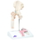 Anatomical Model 12-4577 3B Scientific Anatomical Model - Femoral Fracture And Hip Osteoarthritis - Includes 3B Smart Anatomy, Price/Each