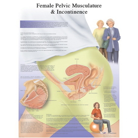3B Scientific 12-4632P Anatomical Chart - Female Urinary Incontinence Chart, Paper