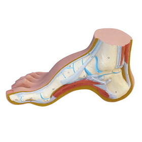Anatomical Model 12-4803 3B Scientific Anatomical Model - Hollow Foot (Pes Cavus) - Includes 3B Smart Anatomy