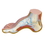 Anatomical Model 12-4803 3B Scientific Anatomical Model - Hollow Foot (Pes Cavus) - Includes 3B Smart Anatomy, Price/Each