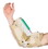 TURNBUCKLE ELBOW ORTHOSIS - SIZE A