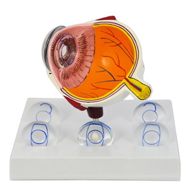 Good-Lite Intraocular Eye Model