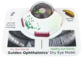 Good-Lite Dry Eye Model