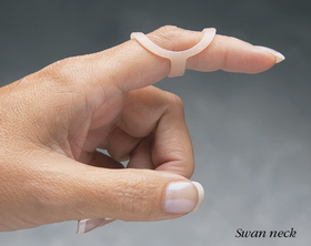 Oval-8 Finger Splints, Refills (Pack of 5)