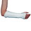 Rolyan A175010 Rolyan AquaForm Zippered Wrist Splint