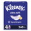 Kleenex KCC54308 Ultra Soft Facial Tissue, 3-Ply, White, 60 Sheets/Box, 4 Boxes/Pack, 3 Packs/Carton, Price/CT